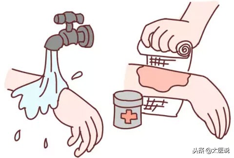 烧伤现场急救三个原则,烧伤的急救原则是什么多选题