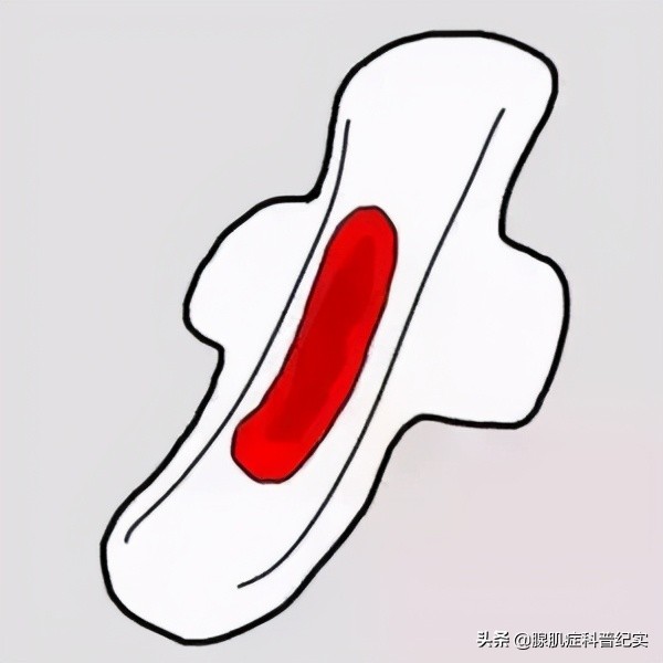 腺肌症诊刮会引起大出血吗,腺肌症能做诊刮吗