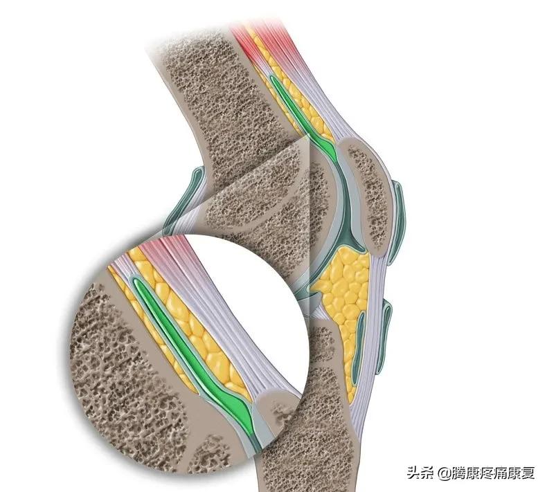 髌股关节疼痛综合症怎么恢复,髌腱疼痛怎么康复