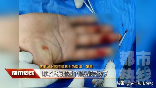 男子手卷入压面机后被救,男子被压面机咬手获救