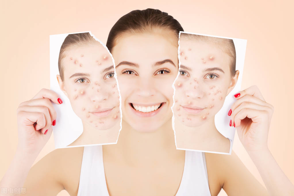 孩子脸上长痘痘怎么快速消除,脸上长痘痘硬块怎么快速消除