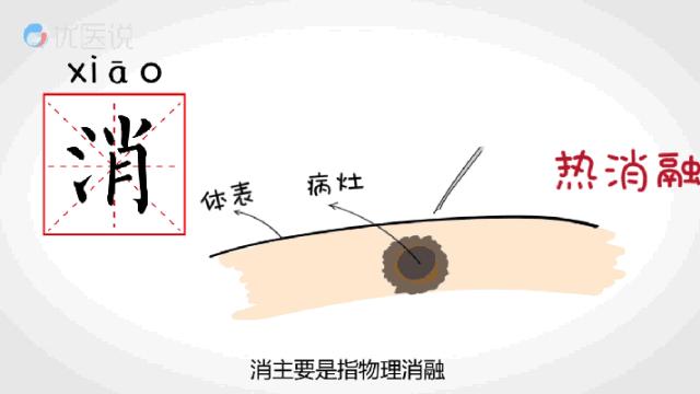 肿瘤微创介入是什么,肝恶性肿瘤微创介入手术全过程