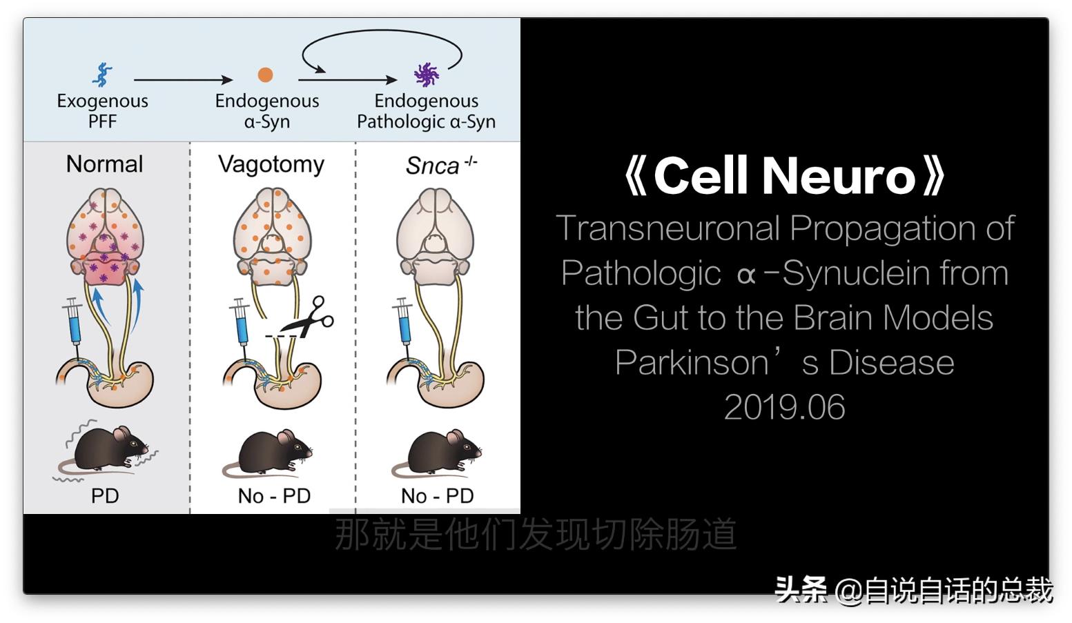 吃翔救命,最奇葩的药,人体“第二大脑”的五个惊奇