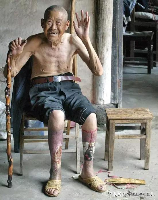 731部队集体逃脱制裁之谜,731部队逃脱制裁之谜