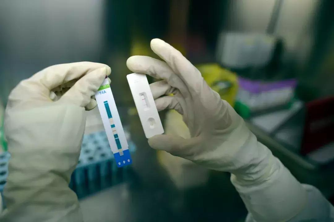 网上卖的艾滋试纸四代窗口期,去哪里买的艾滋病检测试纸最可靠