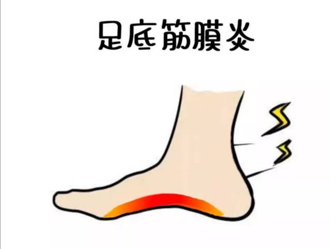 中医说筋膜炎,我得了筋膜炎怎么治疗