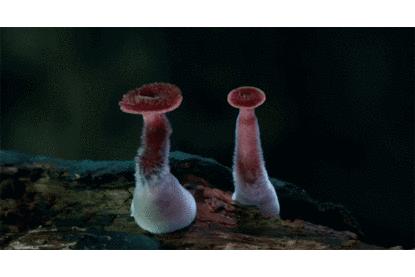 “肛”湖问道|肠治久安，息肉早切除