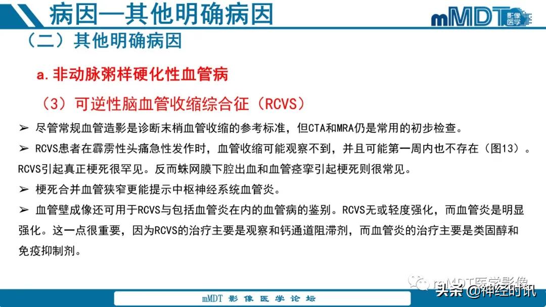 急性缺血性脑卒中ppt素材图片,青年缺血性脑卒中ppt
