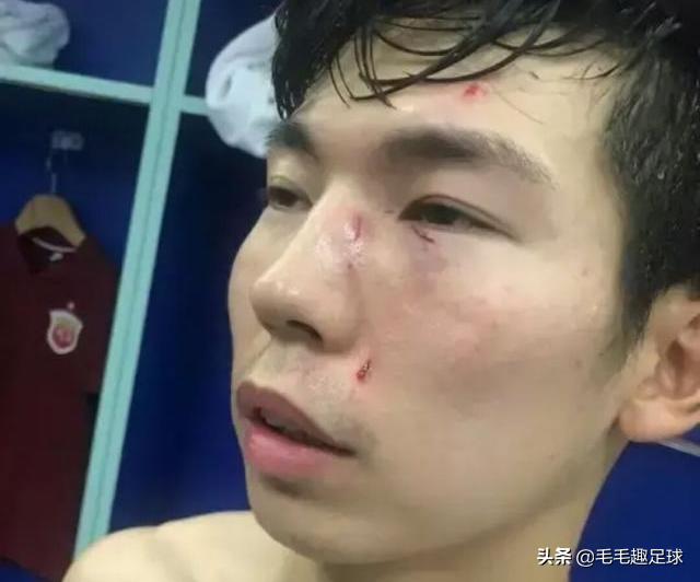 保利尼奥上港凌空抽射,中超比赛出现揪心一幕