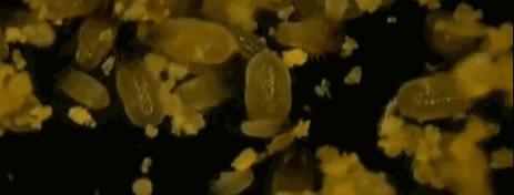 鼻子起痘都能挤出很多白色油脂,鼻子白色的痘痘挤出来有痘坑吗