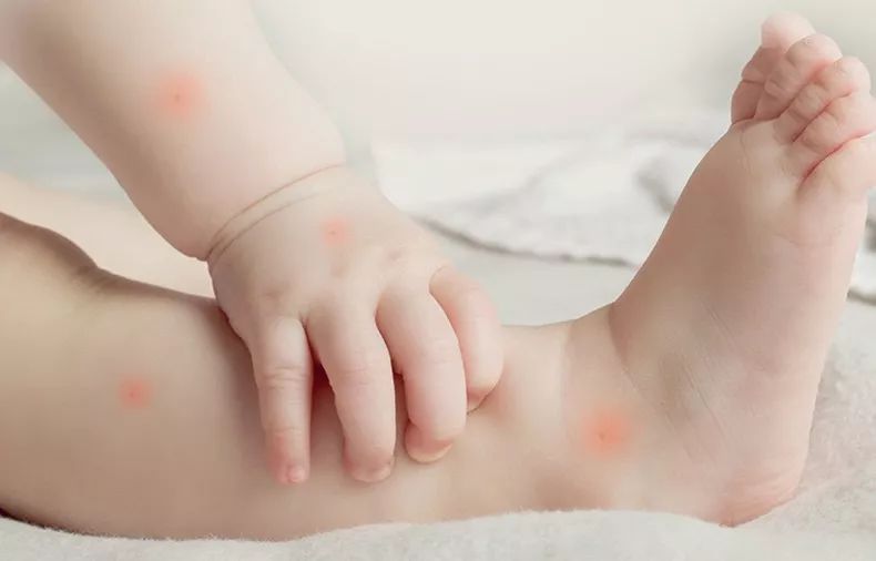 15天众筹10万元，MANYKA（麦蜜卡）产品的魅力何在？！