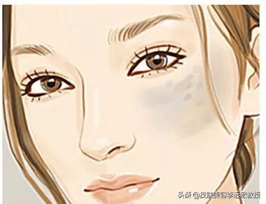 做一个脸上无斑的女人,女人脸上没有斑了