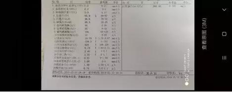 肌酐偏高后怎样注意降低肌酐指标,肌酐低怎么才能退下去