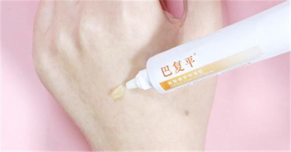 祛痘印的药测评,祛痘印真实有效测评