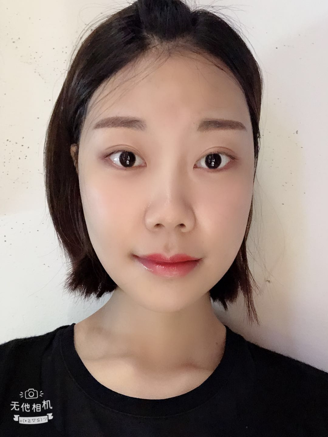 5万整容手术成功案例,女子花50万整容变毁容