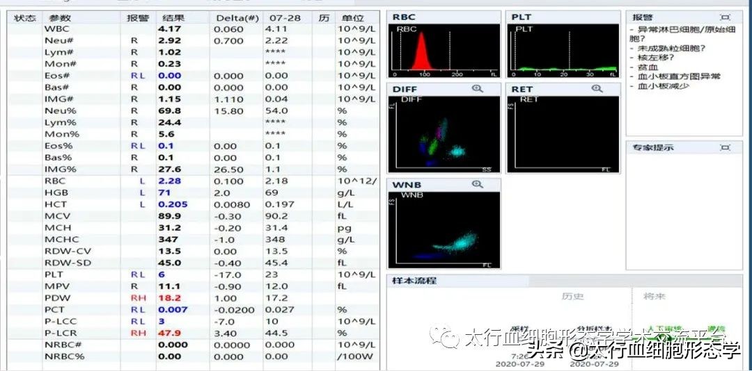 浆质体是什么,浆质体图片