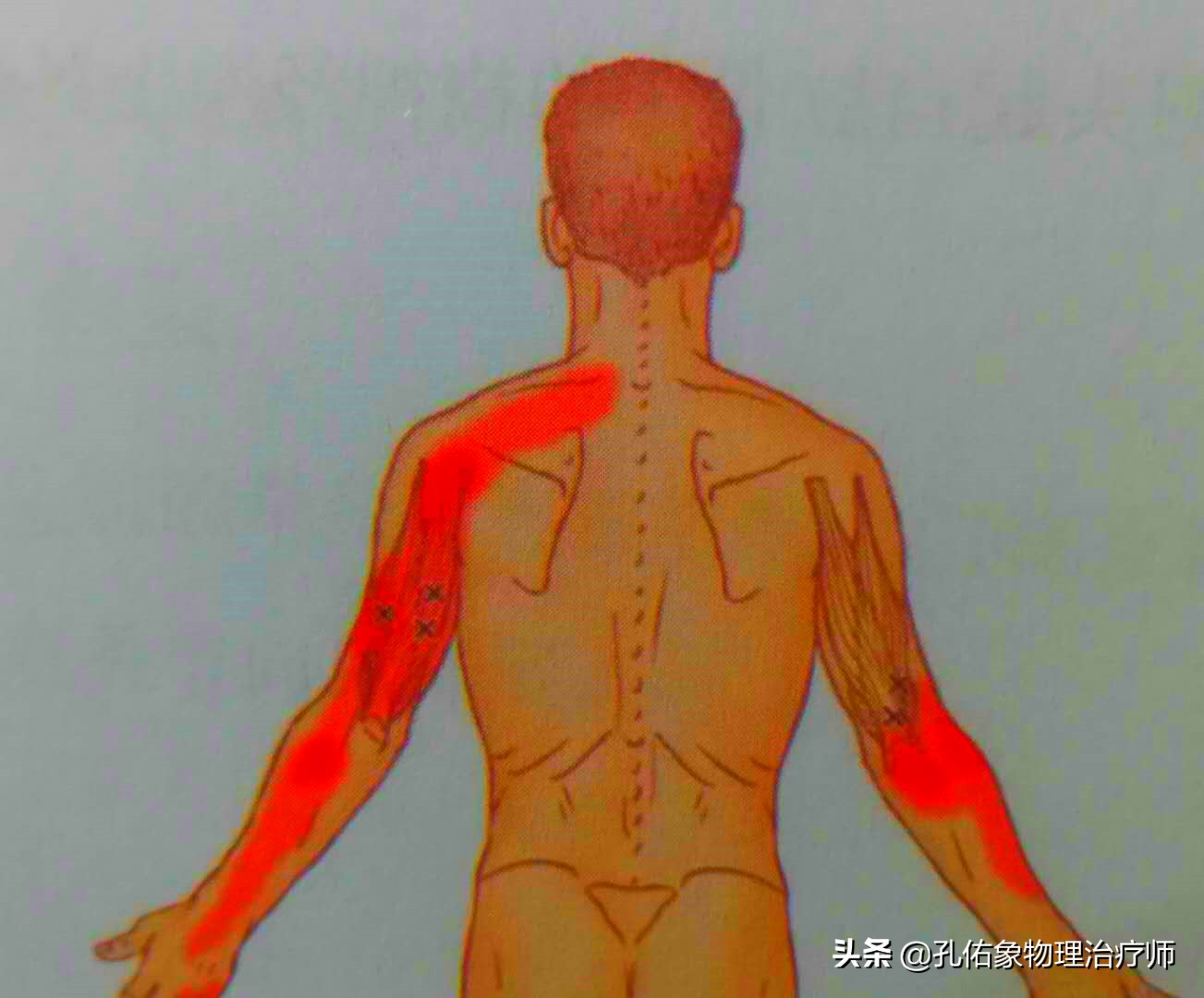 手指麻木是三大疾病前兆,手指麻木疼痛怎么治疗最好
