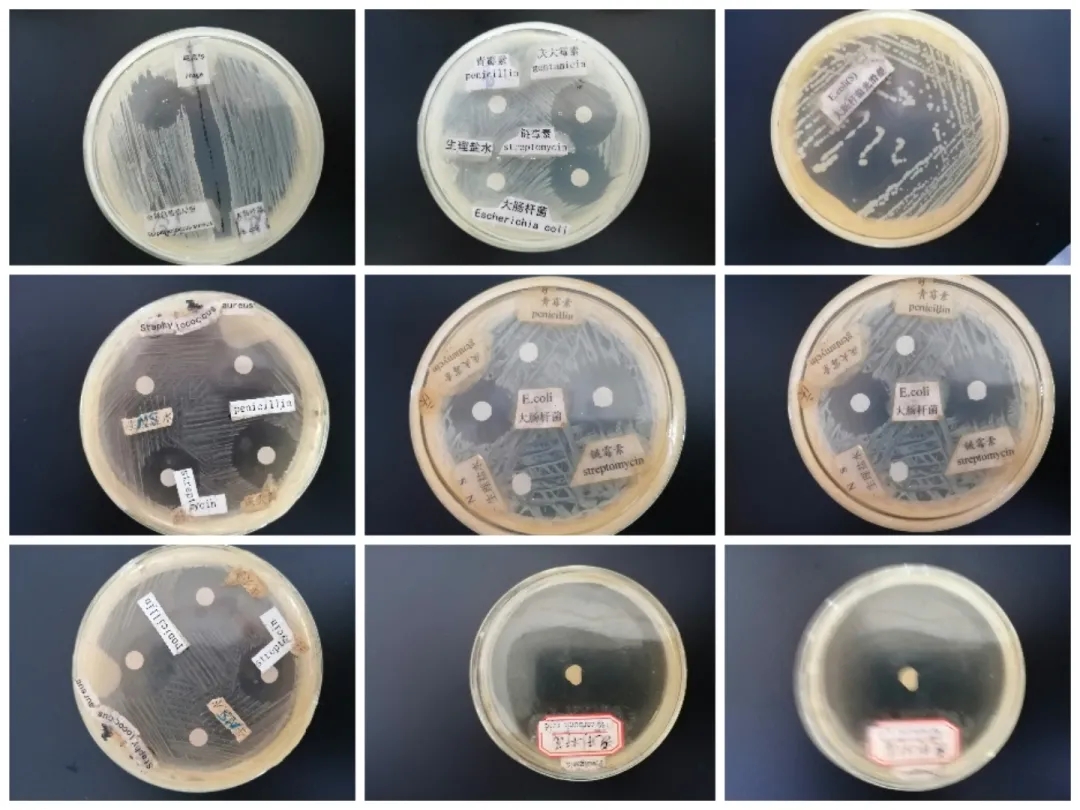 医学生学习打卡做题,医学生学习成果检验视频