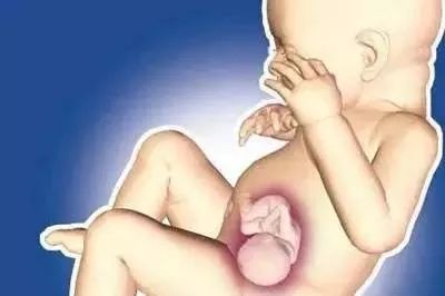 小女孩肚子里长畸胎瘤的原因,14岁女孩长出胎瘤