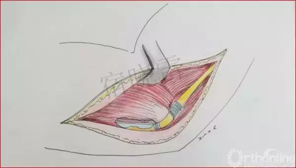 手绘科普视频,手绘类科普