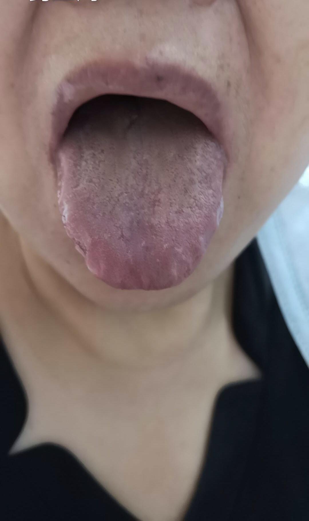 一位30年便秘患者的心里话:吃贾主任的中药,改善的不仅是便秘