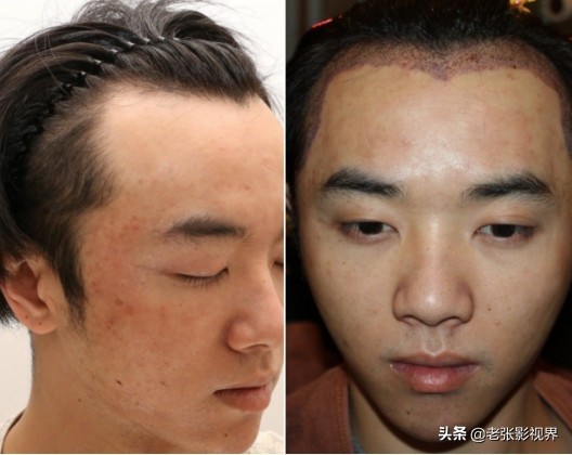 张碧晨和华晨宇现在的情感,圈内人评价华晨宇张碧晨