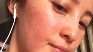 含有哪些成分的护肤品孕妇不能用,虾青素不能和什么护肤品一起用