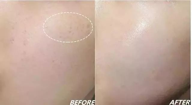 包文婧推荐的护肤品,包文婧用的哪些化妆品