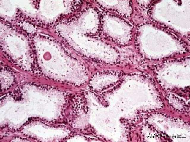 梅毒属于性传播疾病吗,梅毒是怎么传染的会有什么危害