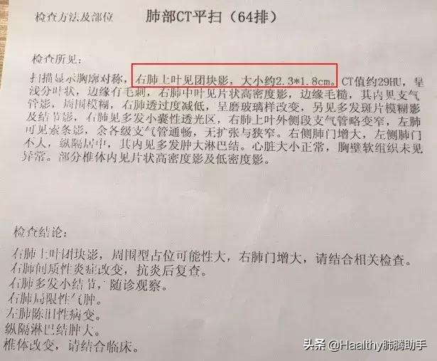 猝不及防确诊肺癌,靶向药副作用一个都没落下,什么让我坚持?