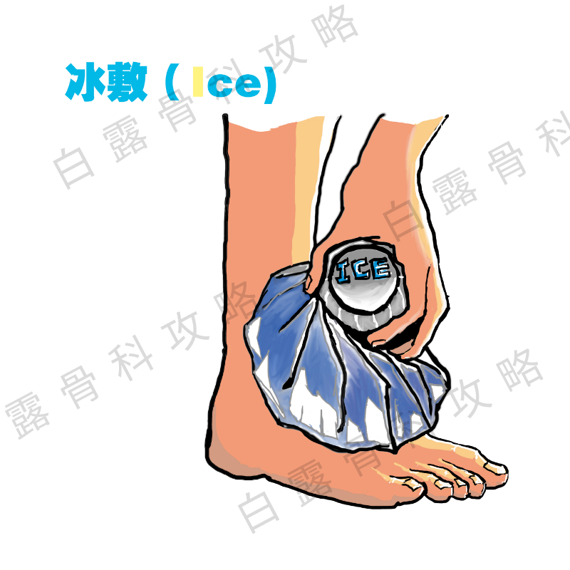 崴脚伤了脚踝怎么处理,崴到脚必须去正骨吗