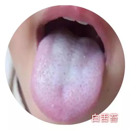 儿童感冒发烧的症状和处理方法,目前小儿感冒发烧有哪些现象