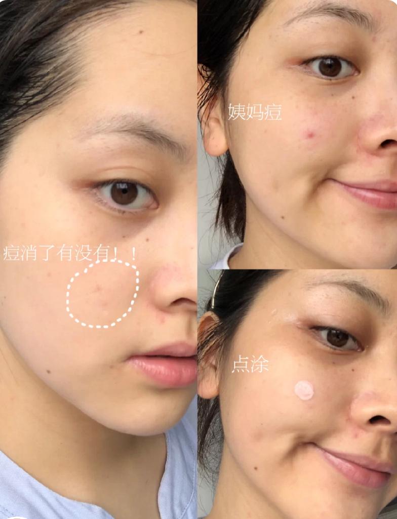 控油保湿的护肤品平价,控油护肤品学生平价套装