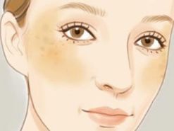 长斑祛痘最好的护肤品,长斑长痘的适合什么护肤品