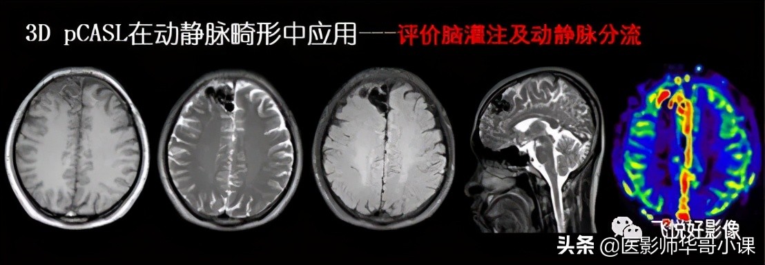 飞利浦磁共振快速扫描方案指南,飞利浦1.5t磁共振各部位扫描技术