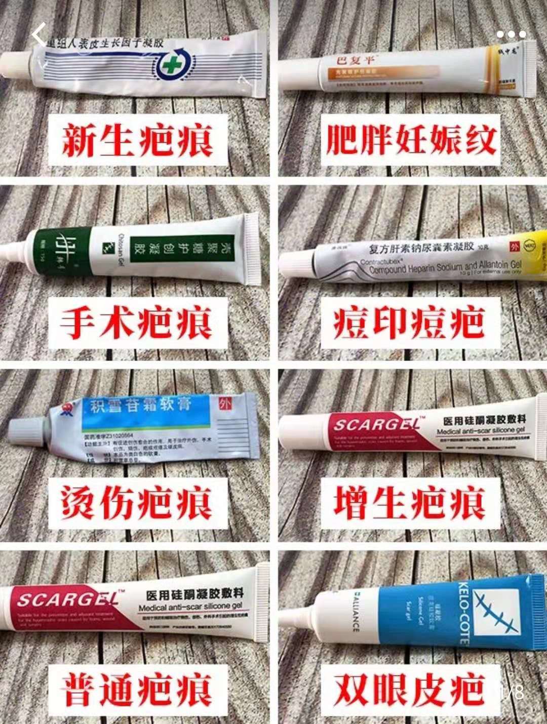 妊娠纹祛疤痕5年了最好的方法,去妊娠纹产后修复排行榜