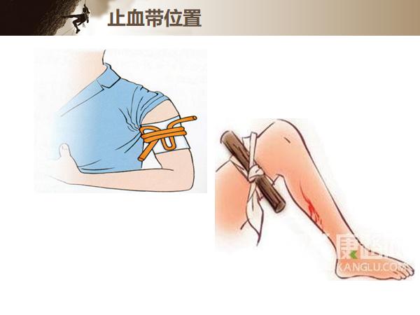 院前创伤评估与救治,院前创伤急救评估