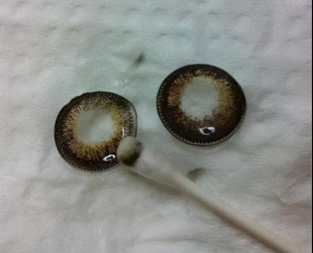 儿童角膜溃疡严重会穿孔吗,儿童角膜溃疡