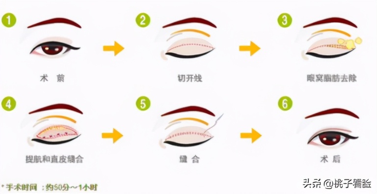 为什么面无表情老被别人认为生气,面无表情老是被人说在生气