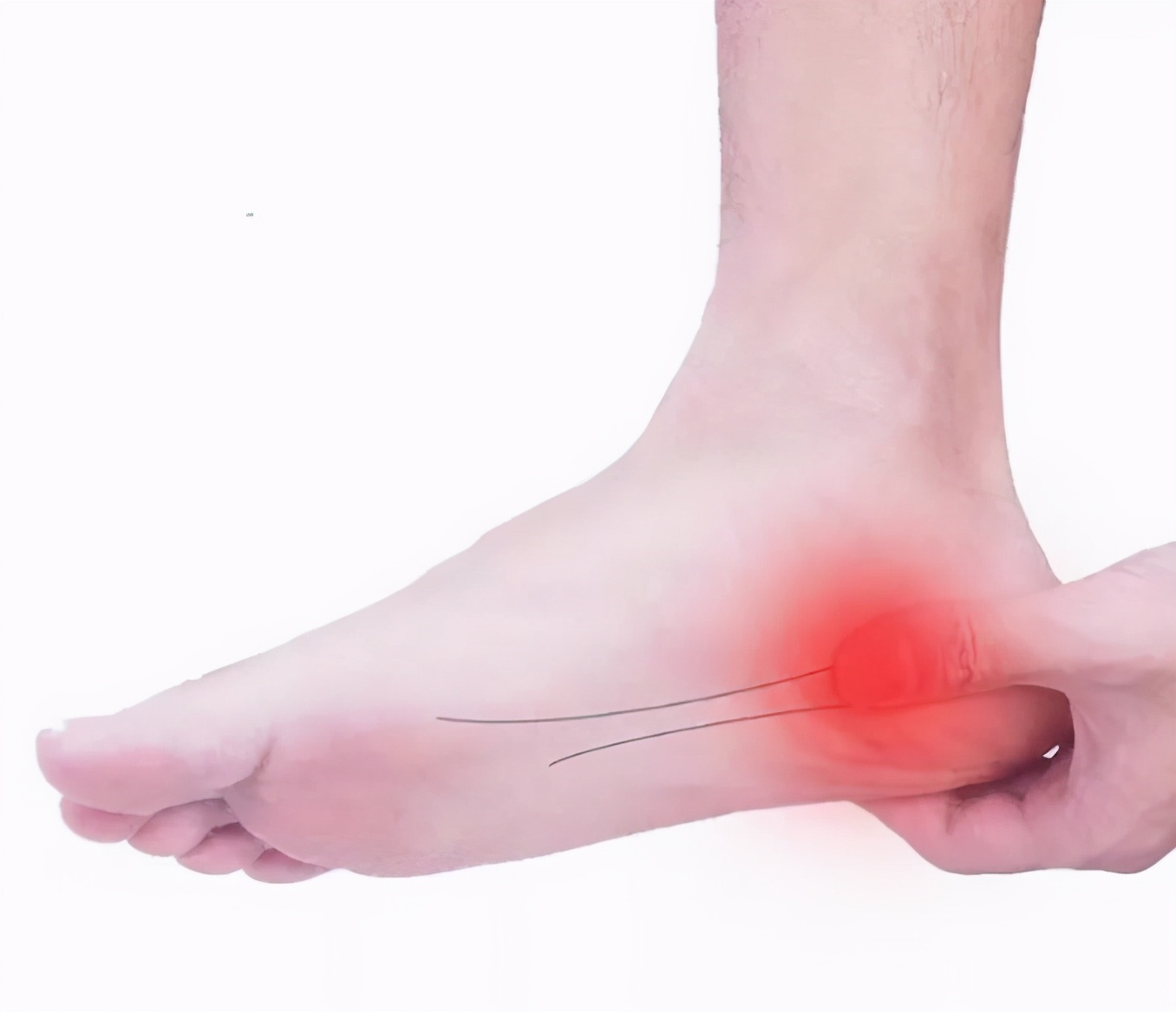 走久了足底痛怎么缓解,走了三万多步脚痛怎么解决