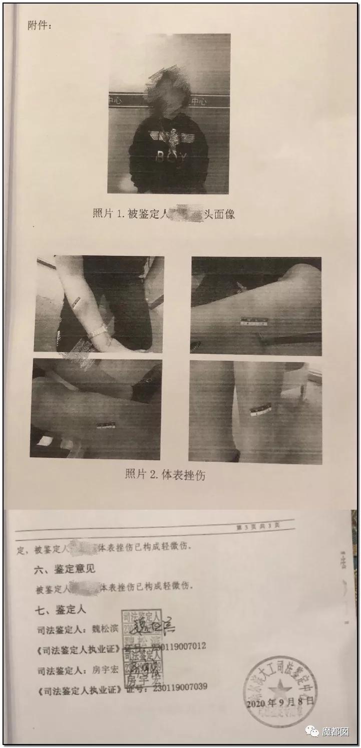 短跑名将张培萌被曝家暴反转,短跑名将张培萌家暴背后