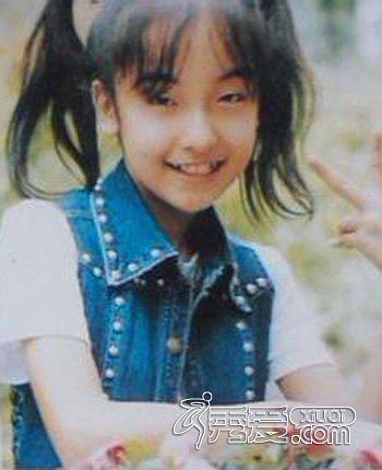 这个你察觉不到的小手术，滨崎步和80%的日本女星都做过它