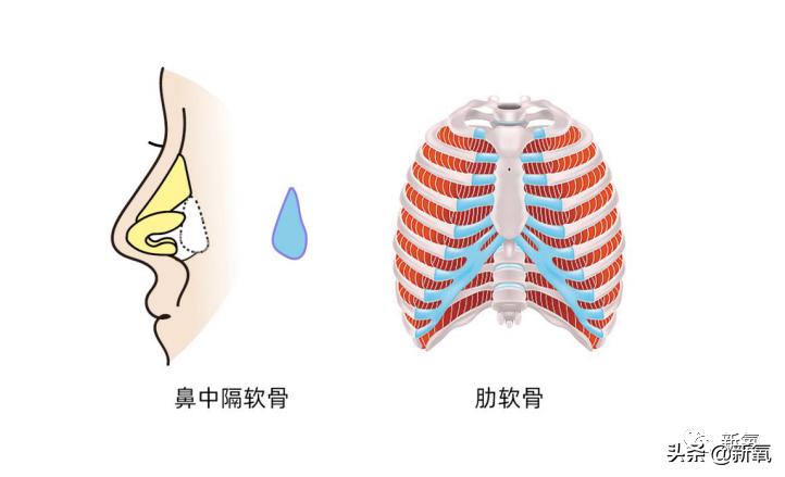 村姑整成鞠婧祎的鼻子变天使,鞠婧祎的鼻子整过吗