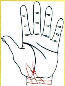 手掌有的地方发黄是不是肝有问题,手掌周围一圈黑是什么原因