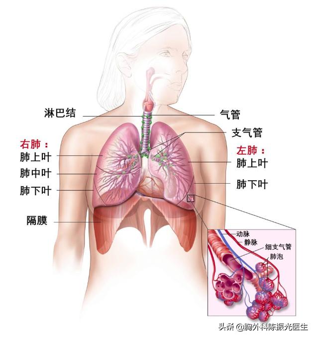 肺癌的分型和分期,肺癌分型t1an1m0是什么意思