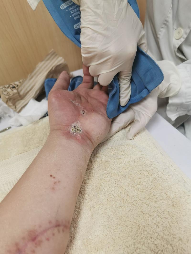 陶勇被砍医生,陶勇出院后的图片