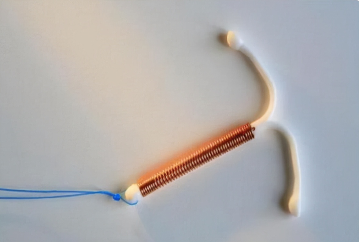 国内第一批上环女性的现状,中国上环的女性多吗