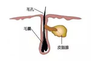 小学学生鼻子长黑头如何快速去除,怎样去除鼻子上的螨虫和黑头
