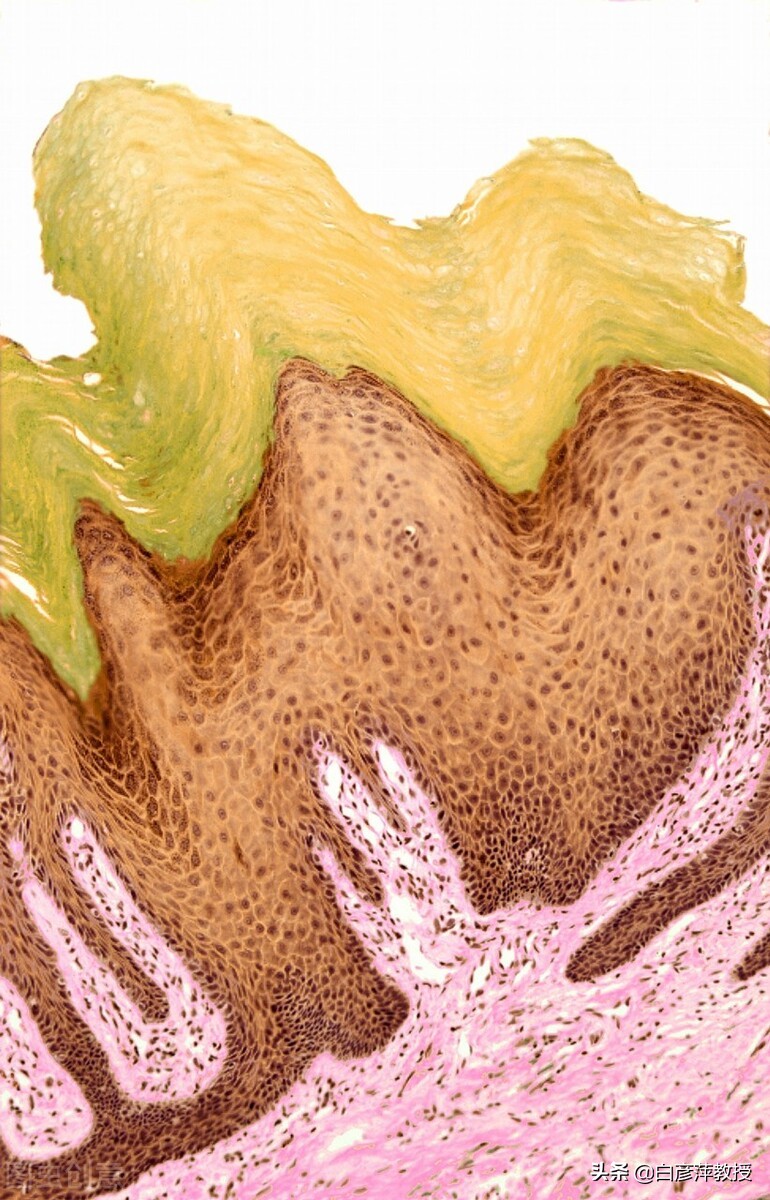 皮肤科医生眼中的真相,皮肤科激素皮炎