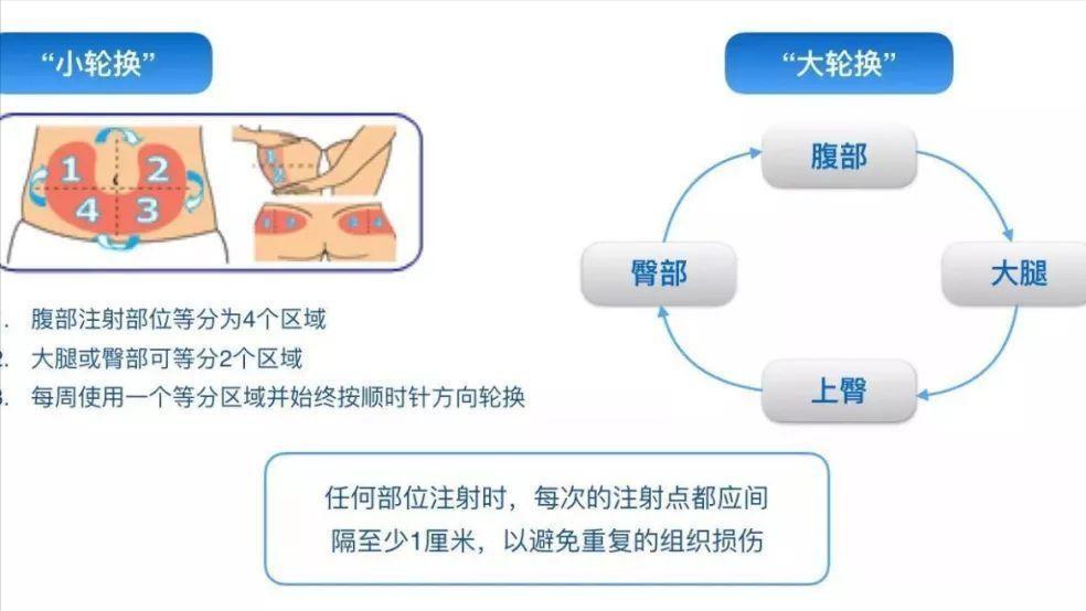 为什么先注射胰岛素再注射葡萄糖,胰岛素注射笔使用方法及注射部位